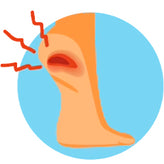 PLANTAR FASCIITIS