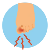 BUNION PAIN