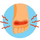 FOOT PAIN